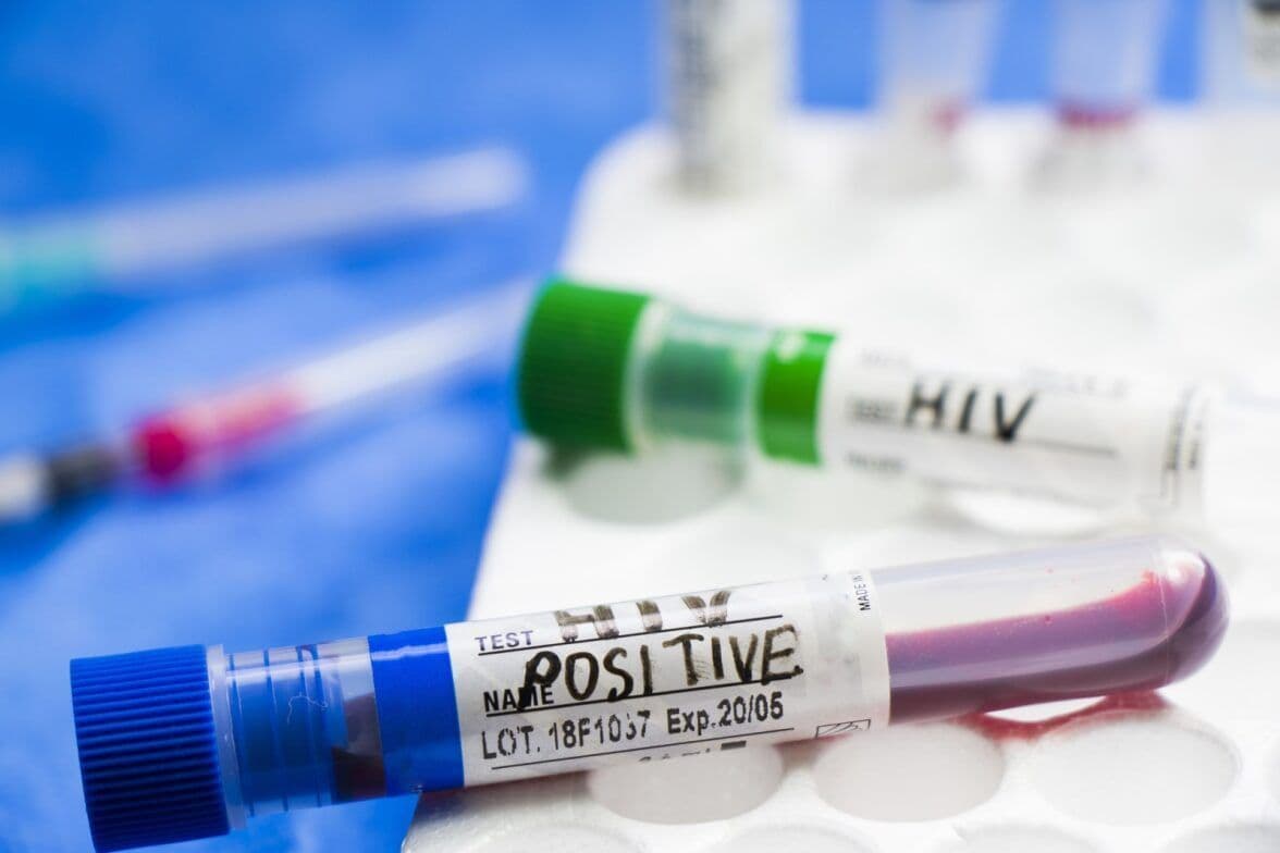 HIV test tubes on a laboratory table; exposure in Oregon hospitals may call for a medical malpractice lawyer.